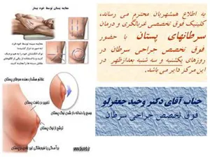 غربالگری سرطان پستان در مرکز اموزشی درمانی الزهرا(س)