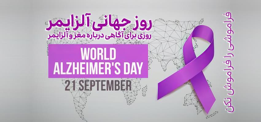آلزایمر